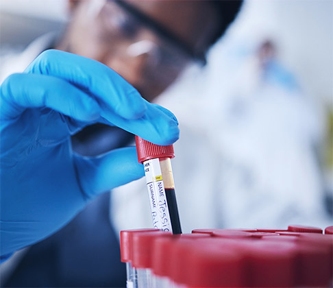 Close up on an African-American lab technician's hand in blue medical glove handling a tube with a patient's blood sample.